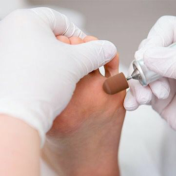 Аппаратный педикюр