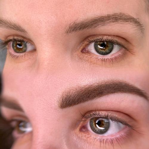 Eyebrow Tattoo Laser Removal NYC